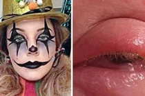 Cô gái suýt mù mắt sau khi hóa trang dịp Halloween