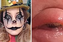 Cô gái suýt mù mắt sau khi hóa trang dịp Halloween