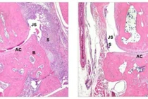 Canada phát triển phương pháp mới điều trị các bệnh tự miễn