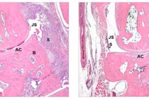 Canada phát triển phương pháp mới điều trị các bệnh tự miễn