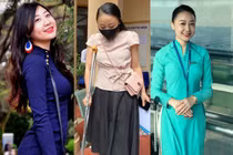 Nữ tiếp viên bị tài xế Mercedes đâm thiệt hại 79% sức khỏe