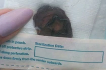 Cô gái suýt chết vì cắt thứ không ngờ... làm quà tặng bạn trai