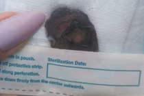 Cô gái suýt chết vì cắt thứ không ngờ... làm quà tặng bạn trai