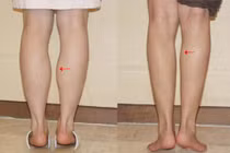 Mách bạn cách giảm mỡ bắp chân cực kỳ dễ