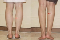 Mách bạn cách giảm mỡ bắp chân cực kỳ dễ