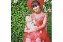 Em bé Lào Cai suy dinh dưỡng năm nào giờ xinh đẹp như công chúa