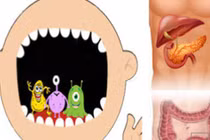 2 loại vi khuẩn trong miệng có thể là "động lực" của ung thư