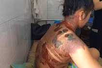 Thanh Hóa: Dội nước sôi vào vợ rồi thản nhiên bỏ đi