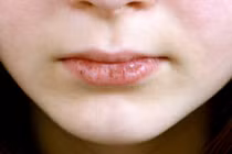 Người dễ mắc bệnh phụ khoa thường có 4 đặc điểm trên mặt