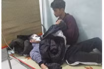 Châm lửa thử xăng, nam thanh niên cháy sém mặt