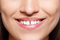 3 tướng răng chứng tỏ số khổ, bị thị phi đeo bám không thôi