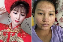 Nhan sắc tàn tạ khi sinh nở, cô gái được chồng chuyển tiền đền bù