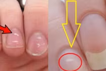 5 bộ phận này chuyển sang màu trắng tiết lộ cơ thể bạn có vấn đề