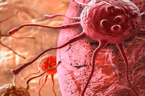 Phát hiện 2 protein ở da người tự hủy tế bào ung thư