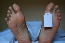 Giải mã hiện tượng xác chết bỗng nóng lên