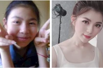 Hotgirl 10x "dậy thì thành công" phủ nhận tin đồn dao kéo