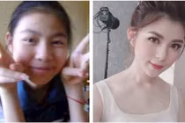 Hotgirl 10x "dậy thì thành công" phủ nhận tin đồn dao kéo