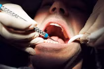 Video: Người đàn ông tự tử vì đau răng khôn mà không được nhổ