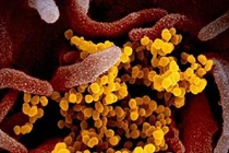 Nga phát triển thiết bị phát hiện virus SARS-CoV-2 trong không khí