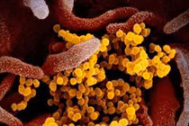 Nga phát triển thiết bị phát hiện virus SARS-CoV-2 trong không khí