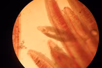 Mang cả vốc sán trong bụng vì nghiện ăn rau sống