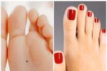 3 dấu hiệu trên bàn chân xấu xí nhưng vô cùng hút lộc
