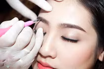 Điều cần phải biết khi chỉnh sửa phần “mái nhà của gương mặt”