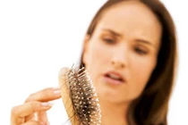 Tóc rụng nhiều do chế độ ăn kiêng thiếu khoa học