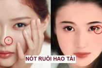 5 nốt ruồi hao tài phá lộc khiến chủ nhân dễ tán gia bại sản