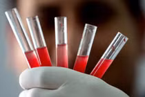 Video: Nhóm máu hiếm nhất thế giới chỉ có 43 người sở hữu