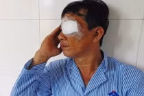 Sơ sẩy trong tích tắc, phải cắt bỏ con mắt