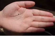 4 nốt ruồi trên cơ thể phụ nữ báo hiệu vận số tốt