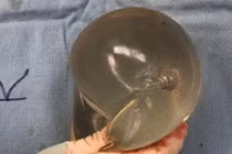 Thấy nóng trong ngực, cô gái mới phát hiện mình bị đạn bắn từ lúc nào