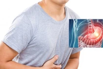 Những ai không nên nội soi dạ dày?