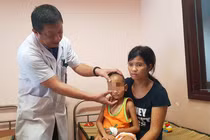 Bệnh lạ khiến cậu bé 5 tuổi bị tụt não xuống mũi