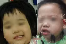 Lý do con liệt mặt, méo mồm sau một đêm khi trời rét đậm