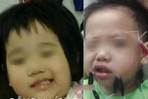 Lý do con liệt mặt, méo mồm sau một đêm khi trời rét đậm