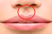 Nhìn điểm này trên mặt người phụ nữ biết ngay số phận hẩm hiu