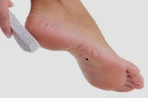 5 dấu hiệu "có của" ở bàn chân người phụ nữ