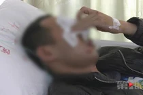 Vì mâu thuẫn nhỏ, chú rể bị nhà gái đánh đến nhập viện