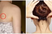 4 vị trí nốt ruồi xấu tới mấy cũng đừng xóa, để đó hưởng phúc đức