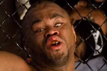 Top 5 gương mặt đáng sợ nhất sau các trận đấu võ thuật