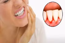 Dấu hiệu của răng miệng báo động tim, gan, thận không khỏe