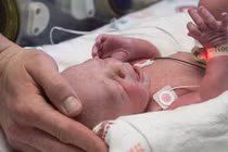 Lần đầu tiên một phụ nữ không có tử cung sinh được con