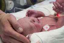 Lần đầu tiên một phụ nữ không có tử cung sinh được con