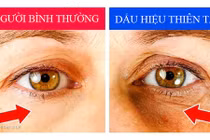 7 dấu hiệu nhận biết thiên tài cha mẹ cần đặc biệt lưu ý