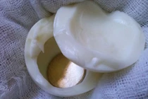 Phương pháp cạo gió cắt sốt cho con truyền tai nhau của mẹ bỉm sữa