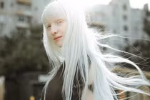 Video: Vẻ ngoài mê đắm của 'mẫu nữ bạch tạng xinh đẹp nhất thế giới'