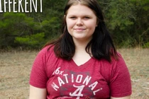 Hội chứng hiếm gặp khiến cơ thể bạn có mùi tanh