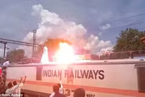 Chàng trai may mắn sống sót sau khi bị điện giật cháy bùng bùng